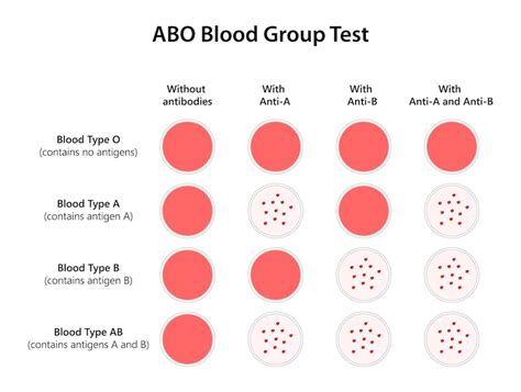 ABO 혈액형 검사